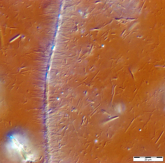 Large Streptobacillus with attached spirochaetes Image_580