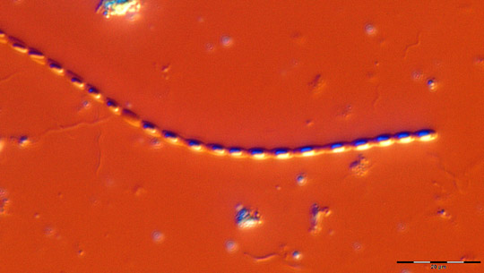Image_3219 streptobacillus with spores