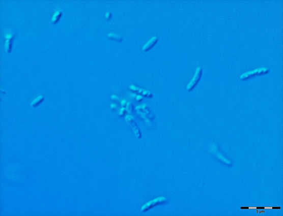 Halobacterium 1 Image_4368