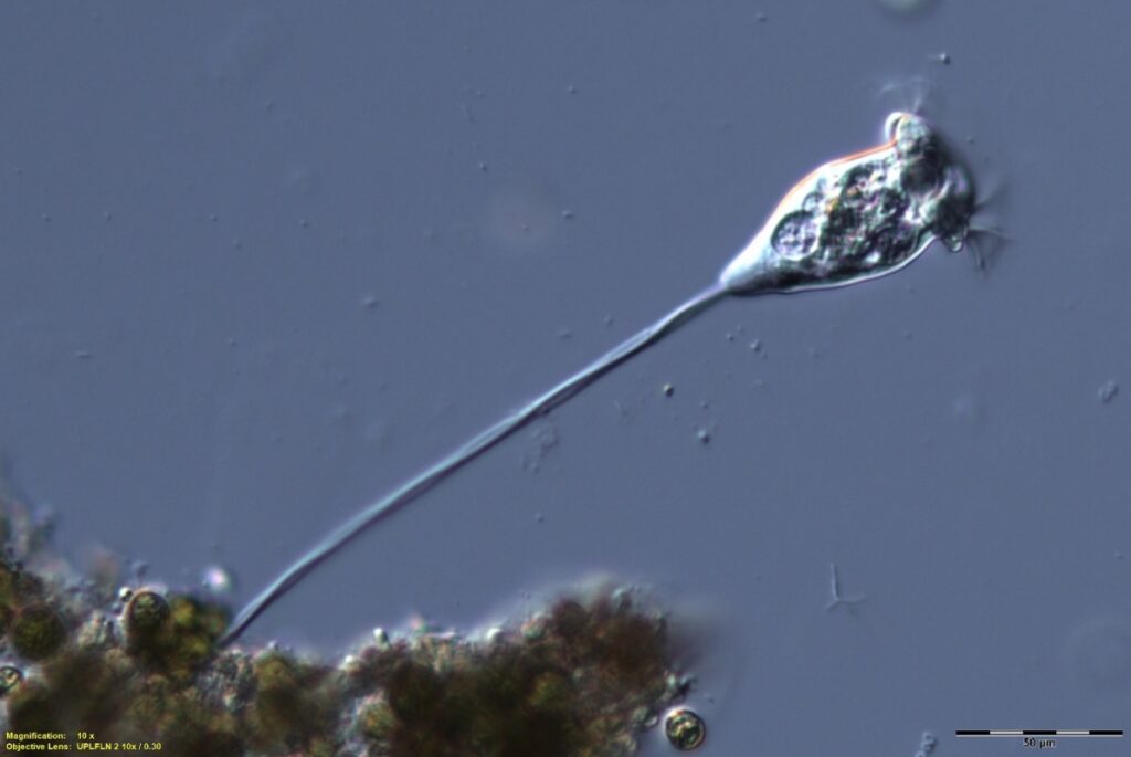 Fig 1: Vorticella convallaria extended and feeding. Collected from a bird bath at our home (DIC image scale bar is 50 microns).