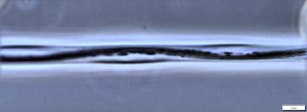 Fig 4: Vorticella stalk in Phase Contrast showing the dark contractile spasmoneme with attached mitochondria inside the transparent stalk sheath, (scale bar is 5 microns).