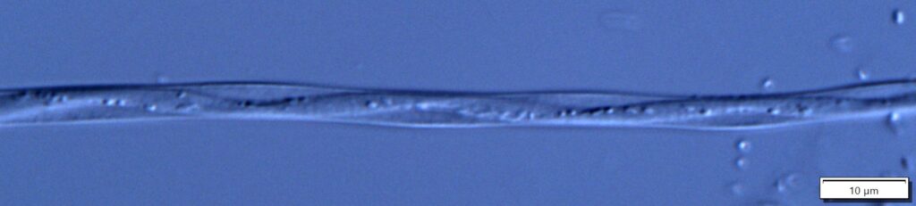 Fig 5: Vorticella stalk using Differential Interference Contrast imaging which reveals finer detail than Phase Contrast. (Olympus 40x 0.95 na UPlanXApo objective).